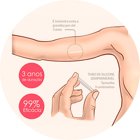 Tratamentos contraceptivos